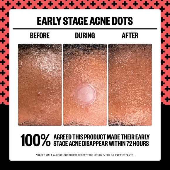 PEACE OUT | Early Stage Acne Dot - 8 acne treatment dots - Picture 5 of 11